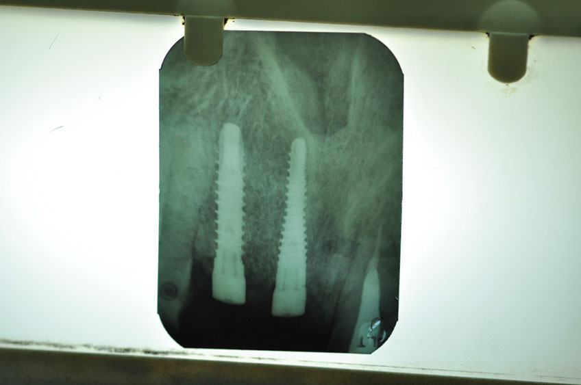 %_tempFileNameImplant%2066d2%