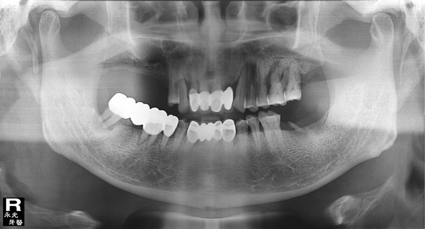 %_tempFileNameImplant%2067d1%