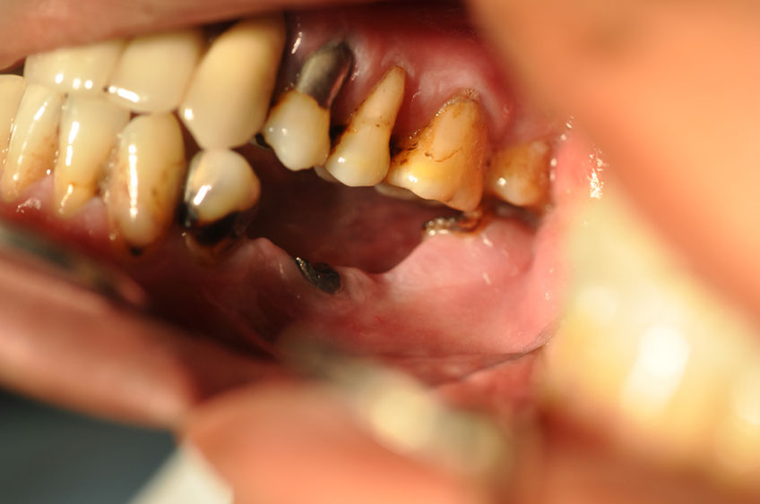 %_tempFileNameImplant%2068a1%