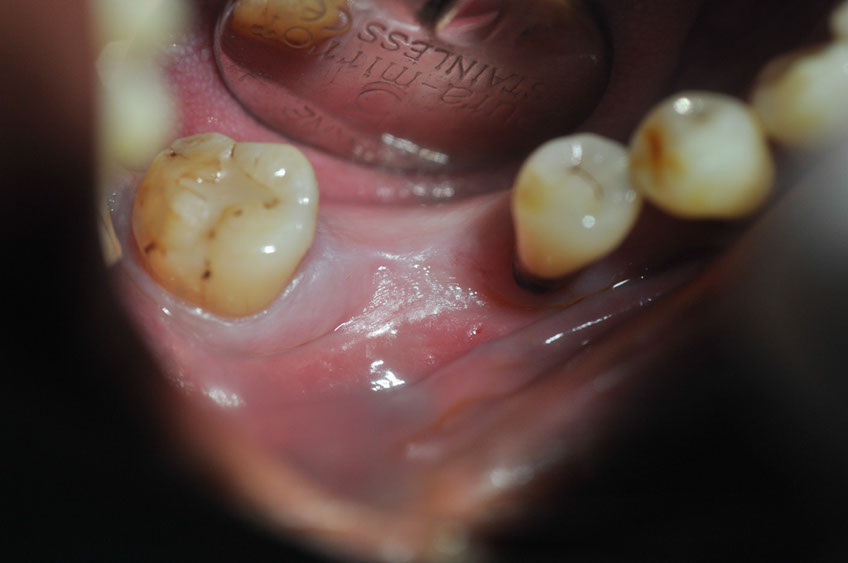 %_tempFileNameImplant%2068a4%