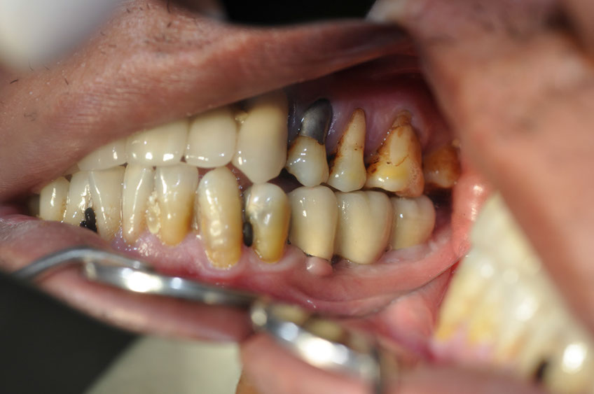 %_tempFileNameImplant%2068c1%