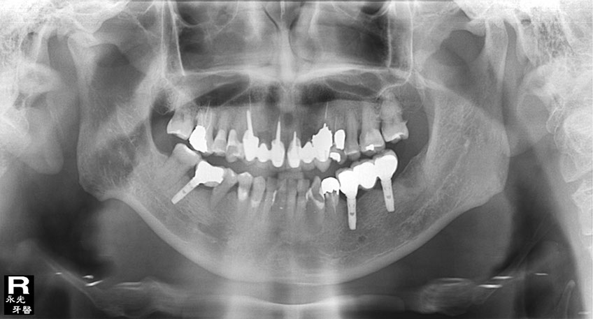 %_tempFileNameImplant%2068d2%