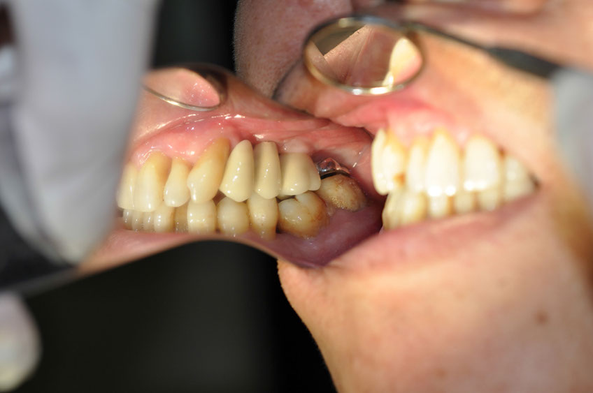 %_tempFileNameImplant%2069c1%