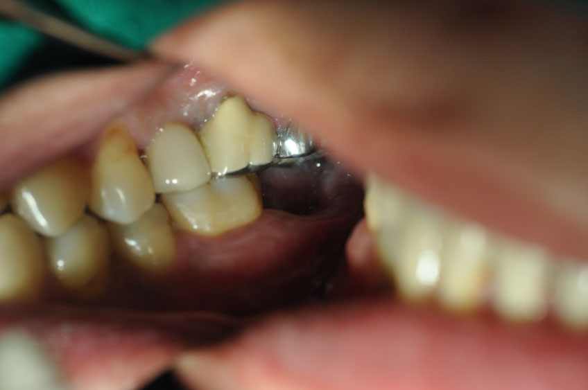 %_tempFileNameImplant%2072a1%