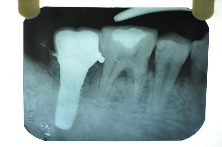 %_tempFileNameImplant%2072d4%