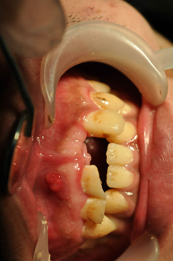 %_tempFileNameImplant%2074a1%