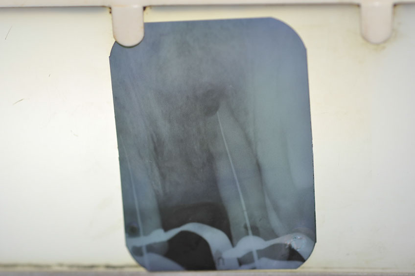 %_tempFileNameImplant%2074a3%