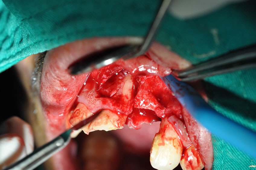 %_tempFileNameImplant%2074b1%