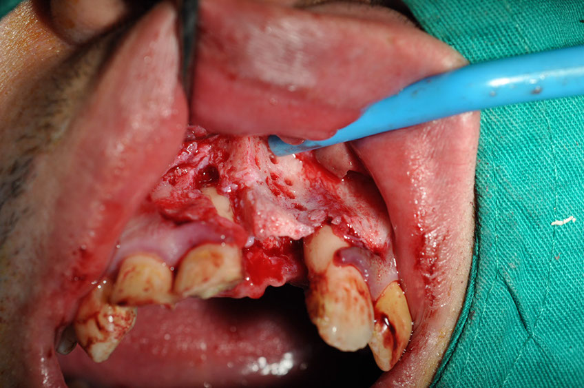 %_tempFileNameImplant%2074b2%