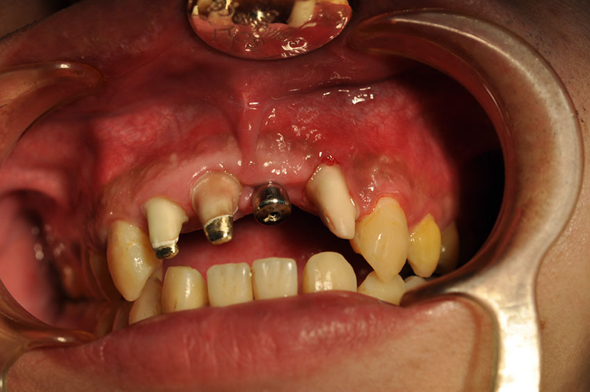 %_tempFileNameImplant%2074c1%
