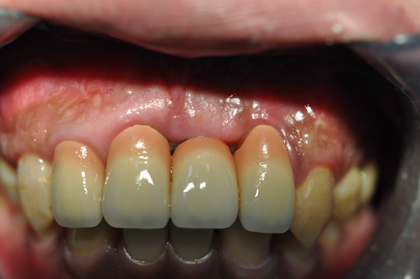 %_tempFileNameImplant%2074c4%