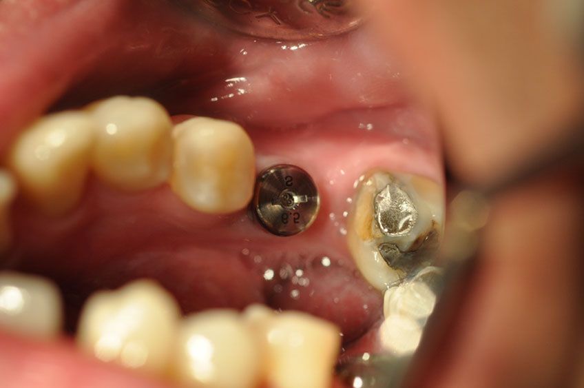 %_tempFileNameImplant%2075b2%