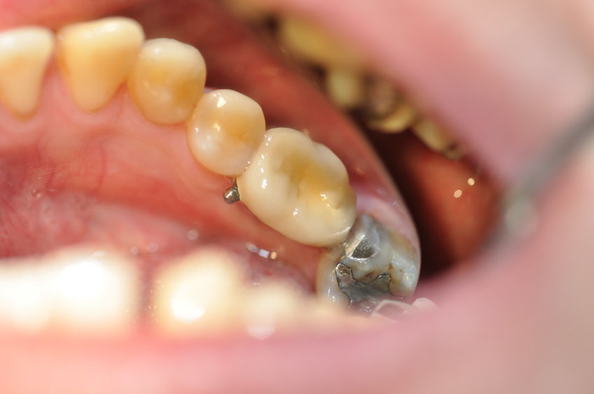 %_tempFileNameImplant%2075c1%