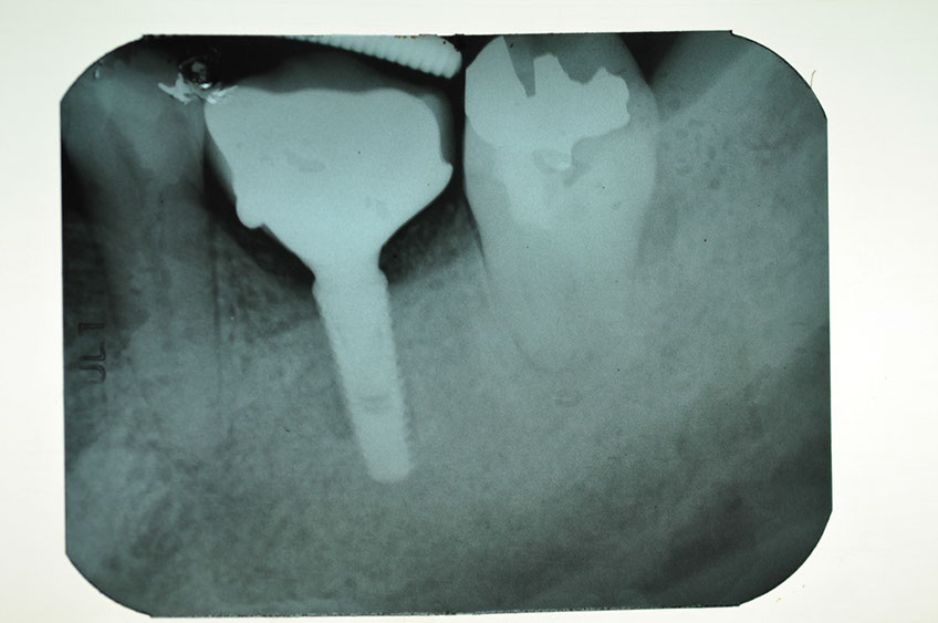 %_tempFileNameImplant%2075c3%