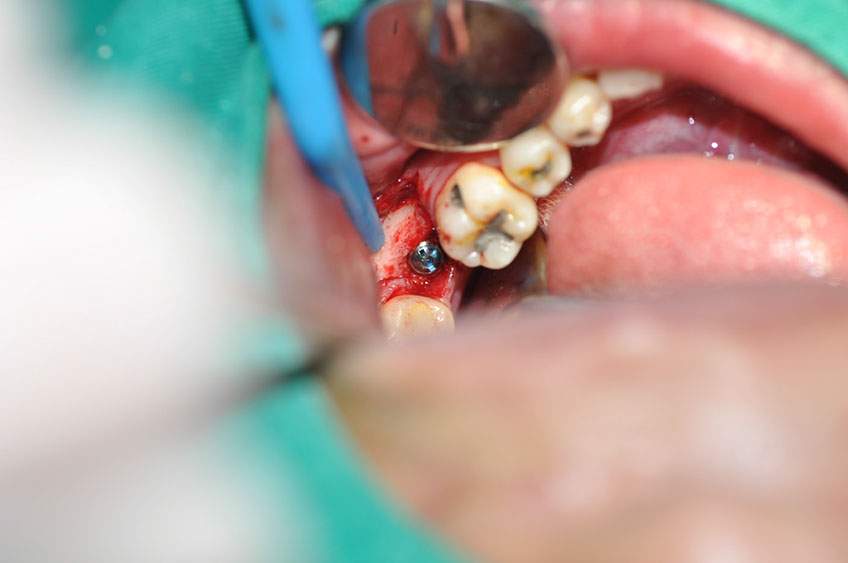 %_tempFileNameImplant%2076b1%