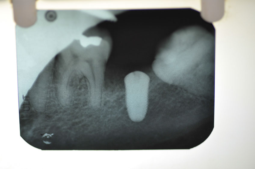 %_tempFileNameImplant%2076b2%
