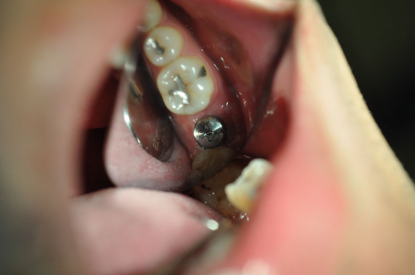 %_tempFileNameImplant%2076b3%