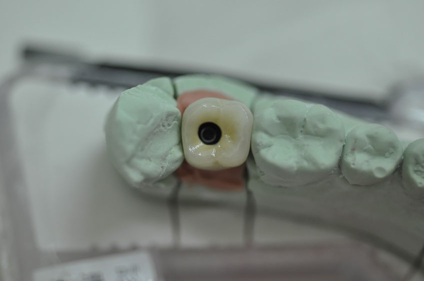 %_tempFileNameImplant%2076c1%