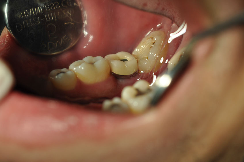 %_tempFileNameImplant%2076c2%