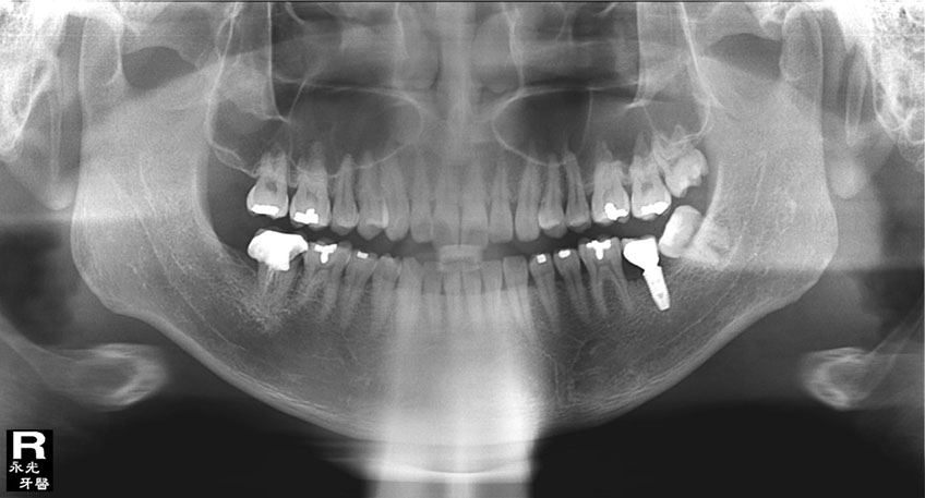 %_tempFileNameImplant%2076d2%