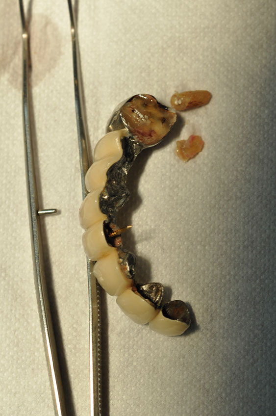 %_tempFileNameImplant%2077a2%