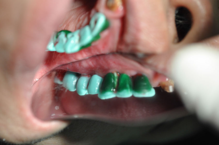 %_tempFileNameImplant%2077b2%