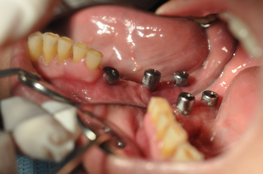 %_tempFileNameImplant%2077b4%