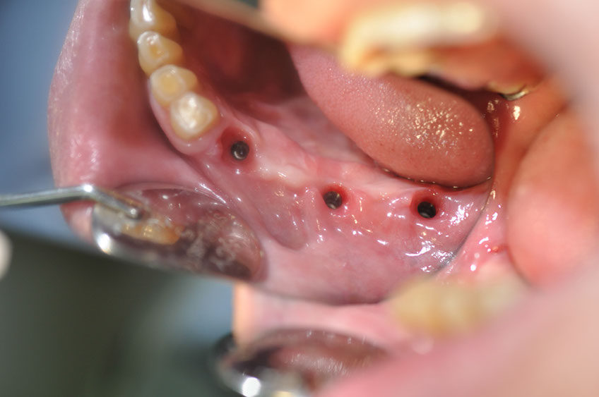 %_tempFileNameImplant%2077b5%