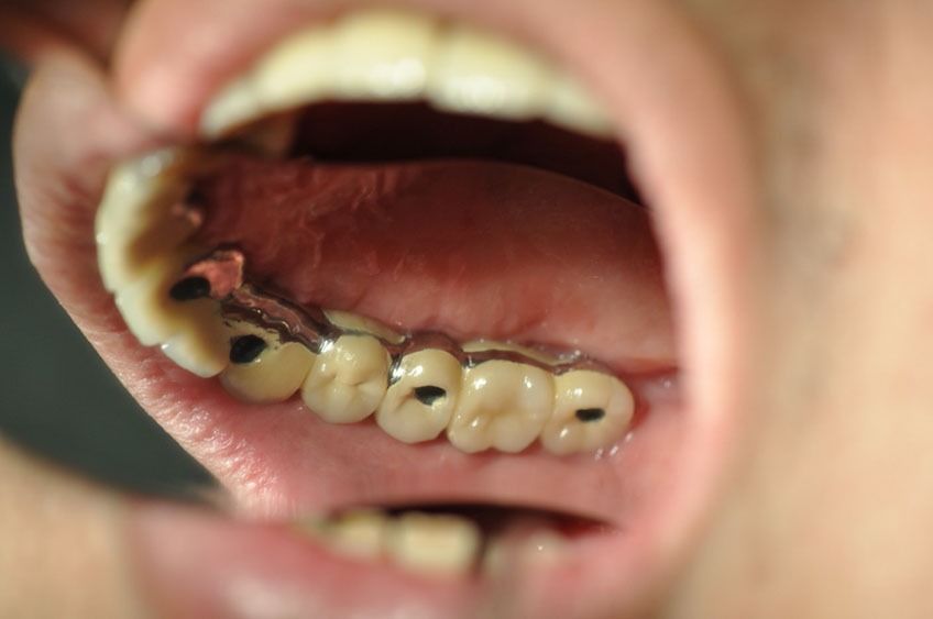 %_tempFileNameImplant%2077c2%