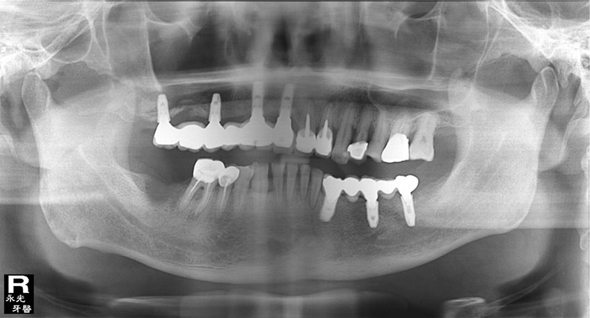%_tempFileNameImplant%2077d3%