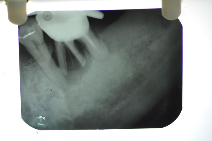 %_tempFileNameImplant%2079a1%