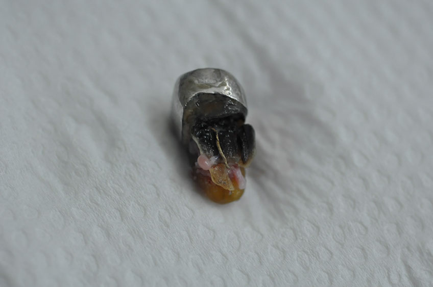 %_tempFileNameImplant%2079a2%