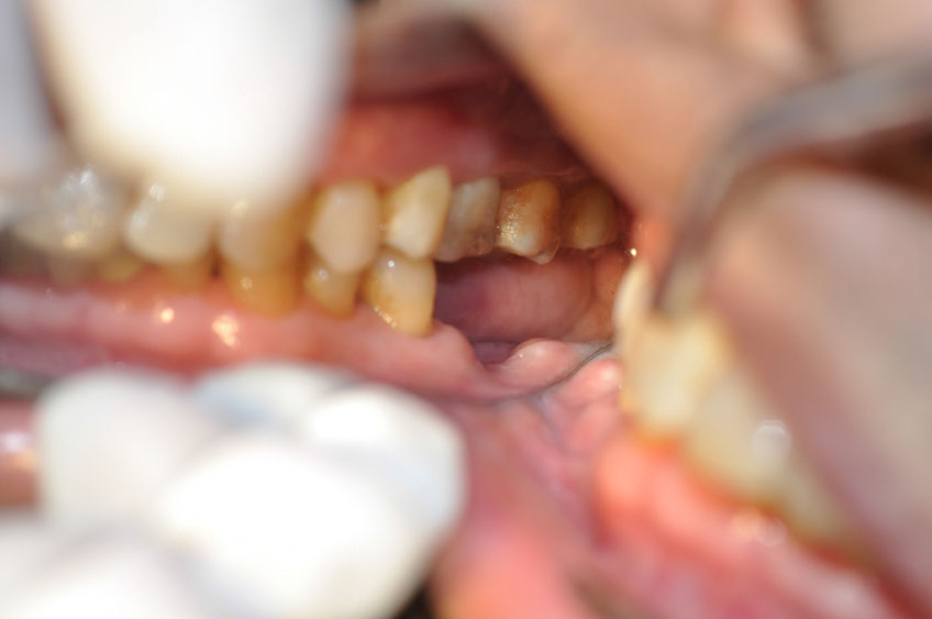 %_tempFileNameImplant%2079a3%