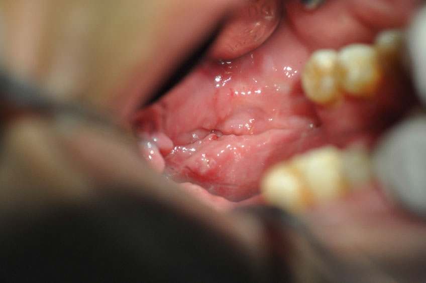 %_tempFileNameImplant%2079b21%