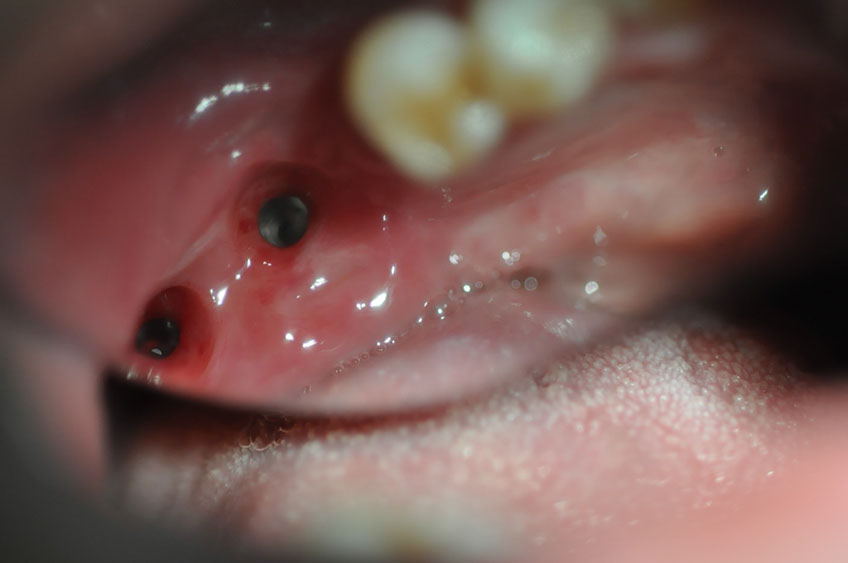 %_tempFileNameImplant%2079b24%