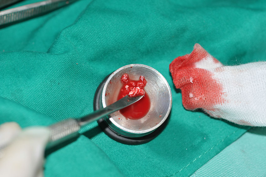 %_tempFileNameImplant%2079b4%