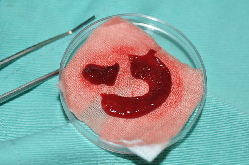 %_tempFileNameImplant%2079b6%