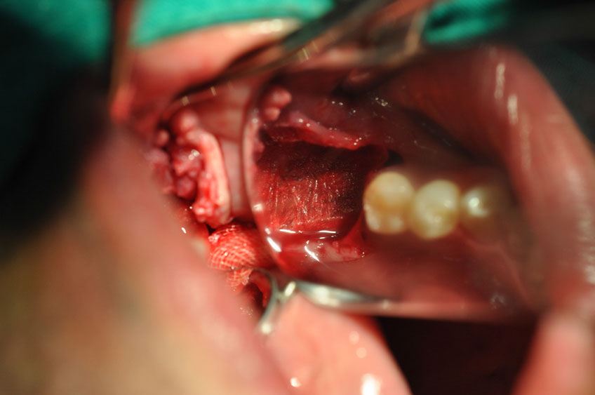 %_tempFileNameImplant%2079b7%