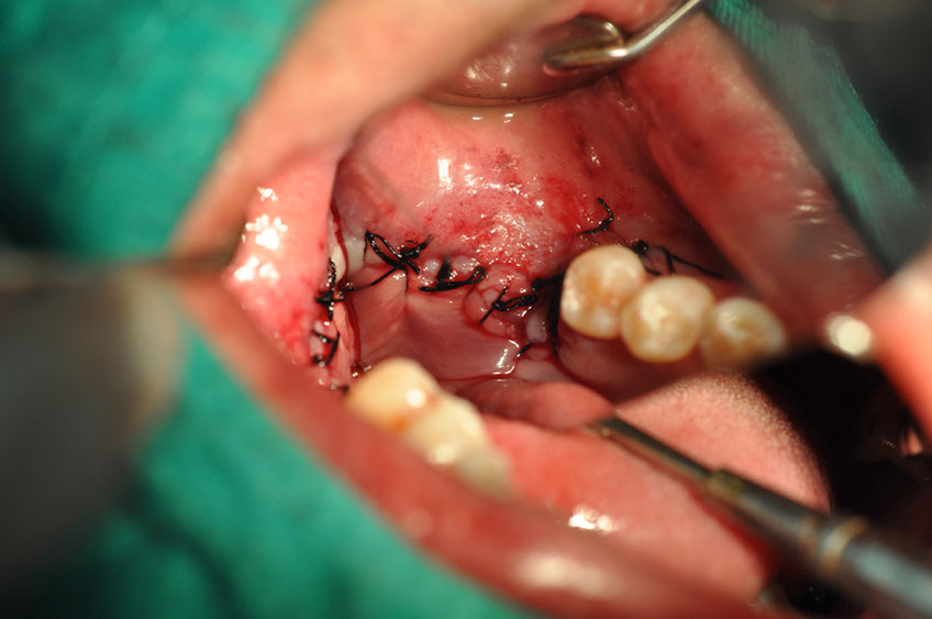 %_tempFileNameImplant%2079b9%20%