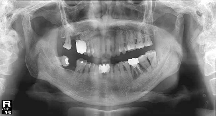 %_tempFileNameImplant%2079d1%