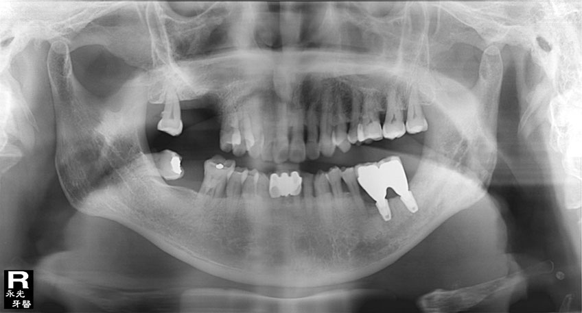 %_tempFileNameImplant%2079d3%