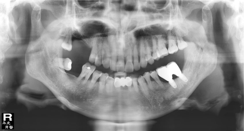 %_tempFileNameImplant%2079d6%