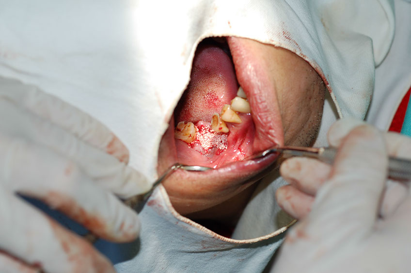 %_tempFileNameImplant%207a2%