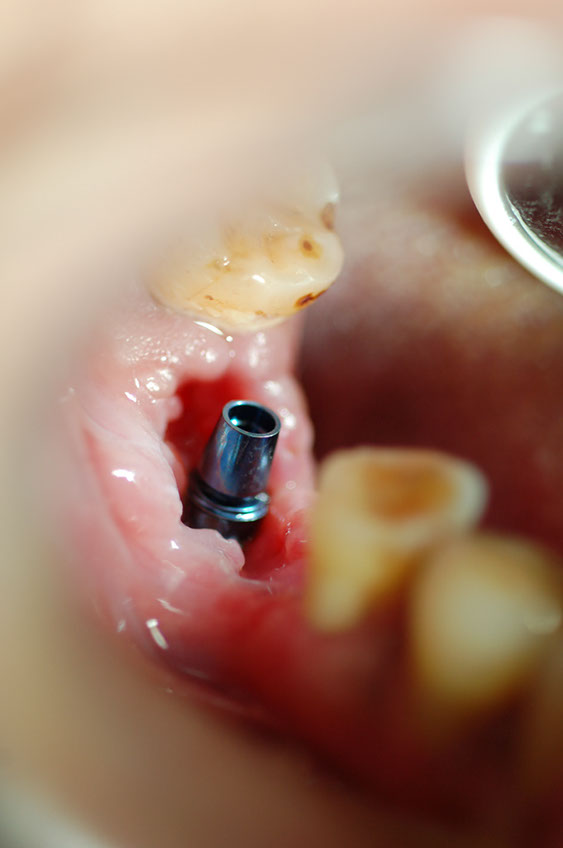 %_tempFileNameImplant%207a4%