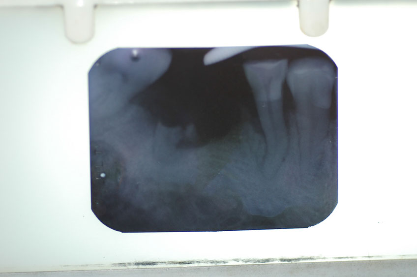 %_tempFileNameImplant%207b1%
