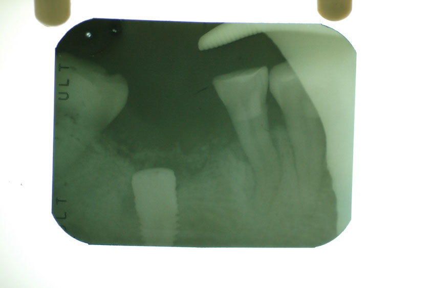 %_tempFileNameImplant%207b2%