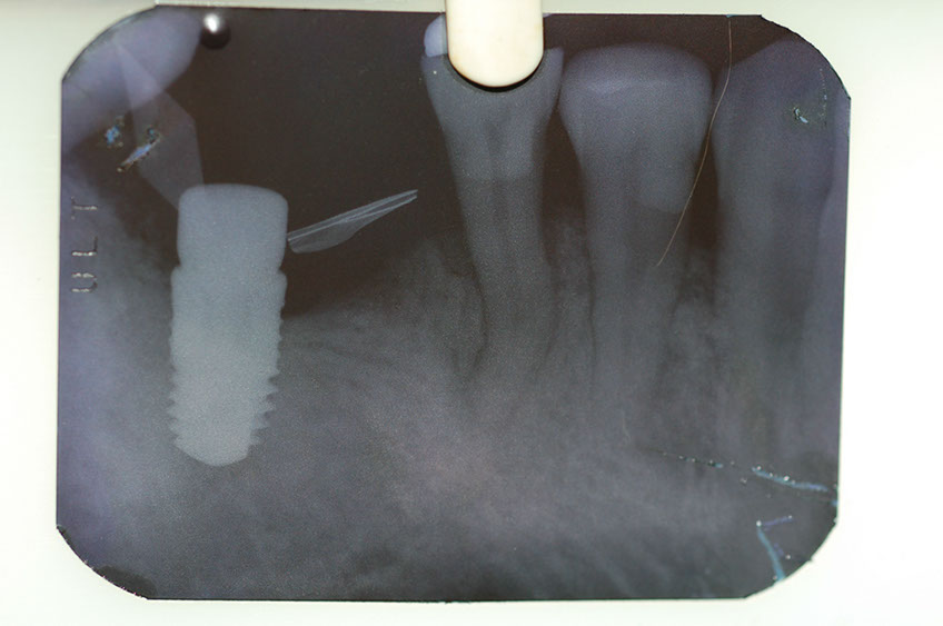 %_tempFileNameImplant%207b5%