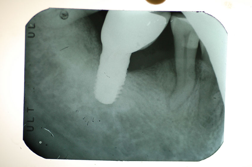 %_tempFileNameImplant%207b6%