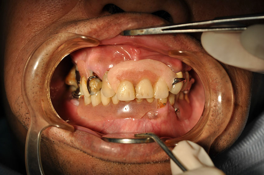 %_tempFileNameImplant%2080a1%