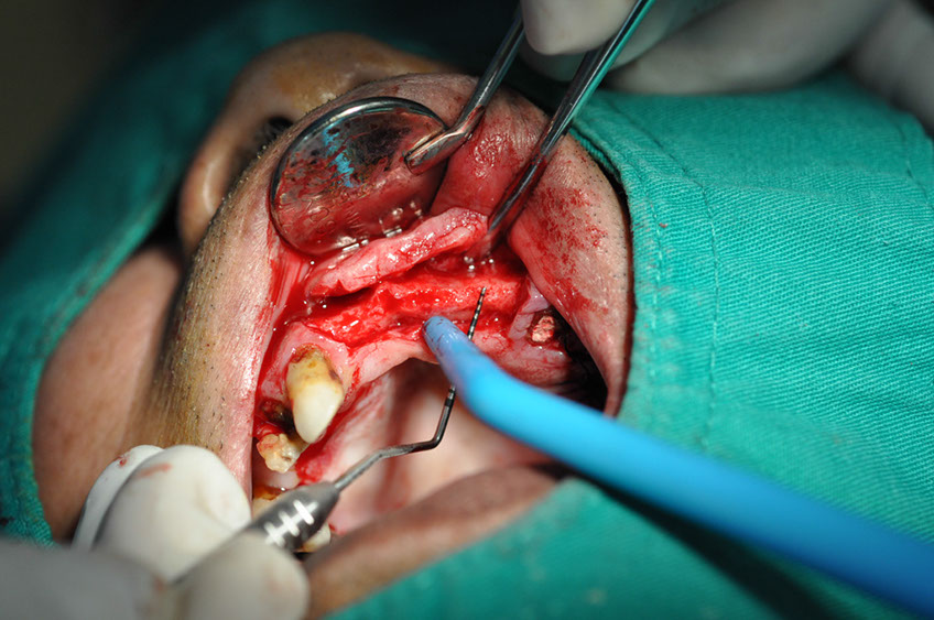 %_tempFileNameImplant%2080b1%